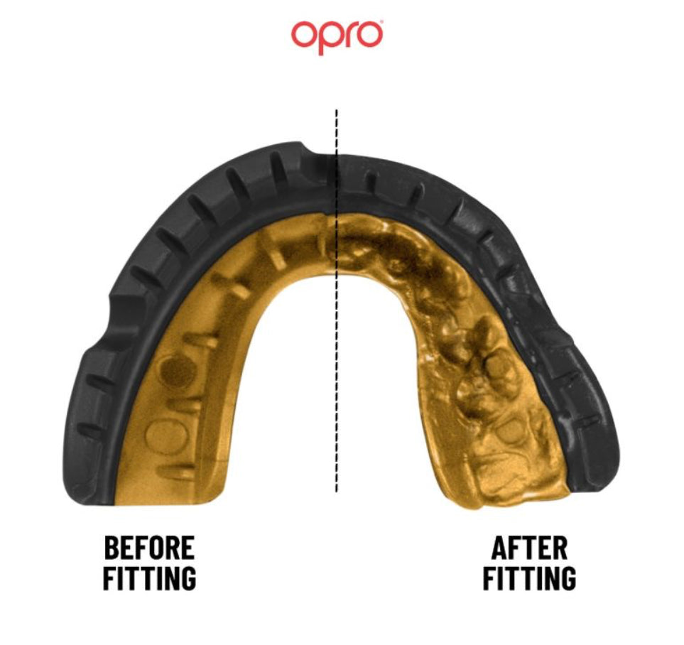 Opro Gold Mouthguard