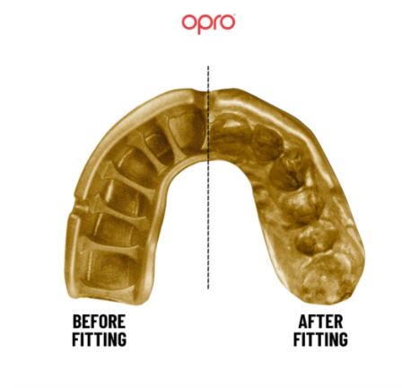 Opro Gold Mouthguard